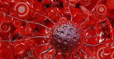 مجموعه مقالات فارسی شامل بیش از ده مقاله در مورد پیش بینی و تشخیص سرطان خون